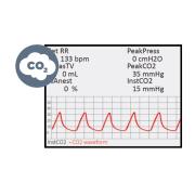CapnoScan® - Endexspiratorischer CO₂ Monitor Modul für PhysioSuite System